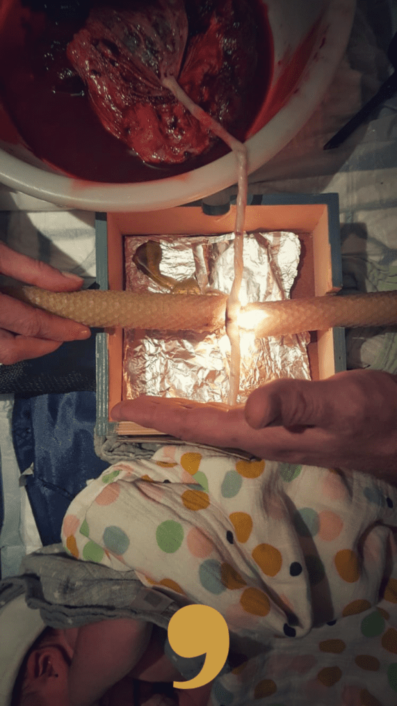 navelstreng doorbranden